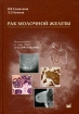 Рак молочной железы Издательство: МЕДпресс-информ, 2009 г Твердый переплет, 176 стр ISBN 5-98322-485-9 Тираж: 1000 экз Формат: 70x100/16 (~167x236 мм) Мелованная бумага, Цветные иллюстрации инфо 7778u.